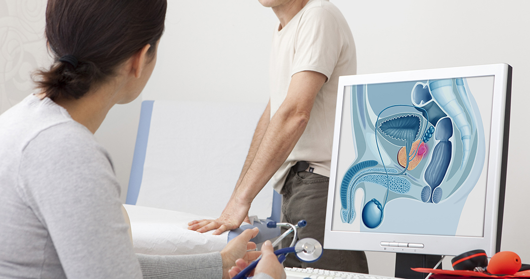 Best Prostate Gland Surgery Doctors in Hyderabad